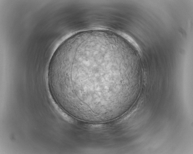 X0000115561431200911201813