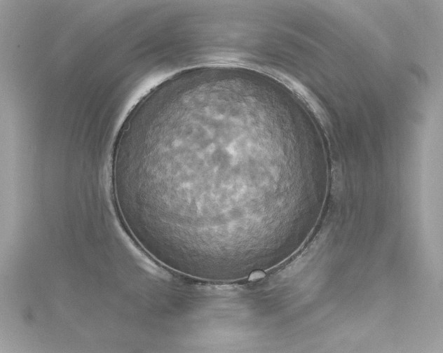 X0000115561432200911201813