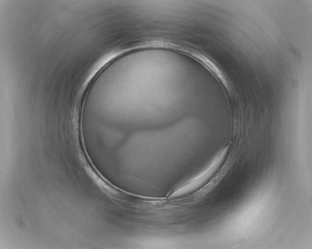 X0000115561438200911201813