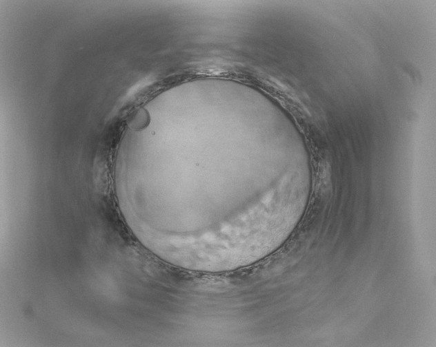 X0000115561446200911201812