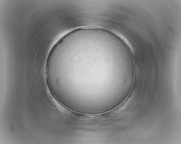 X0000115561485200911201812