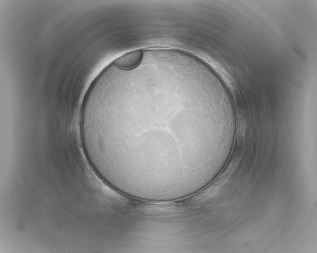 X0000115561486200911201812