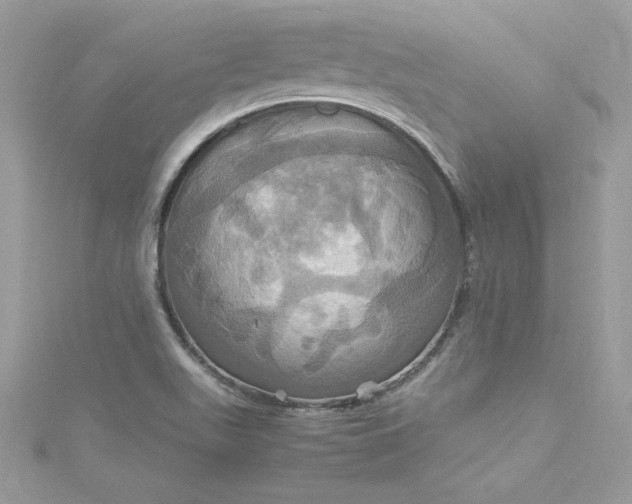 X0000115561511200911201812