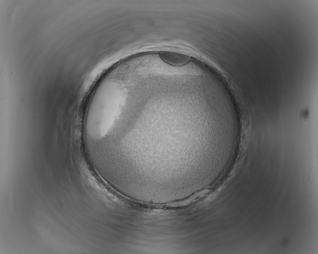 X0000115561506200911271445