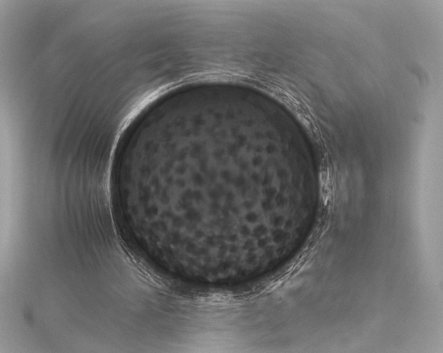 X0000115560196200912041100