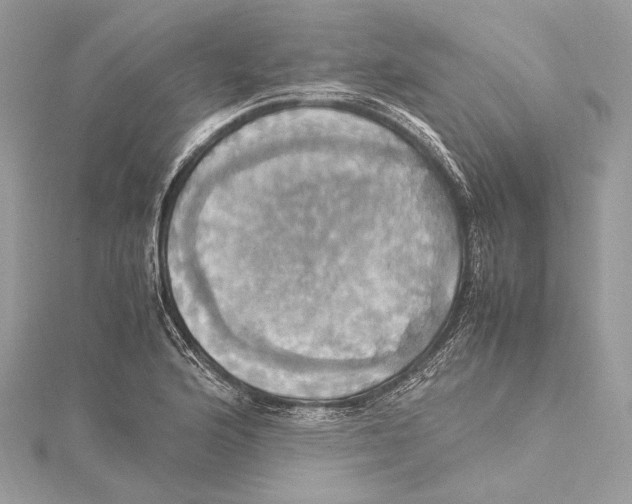 X0000115561176200912041047