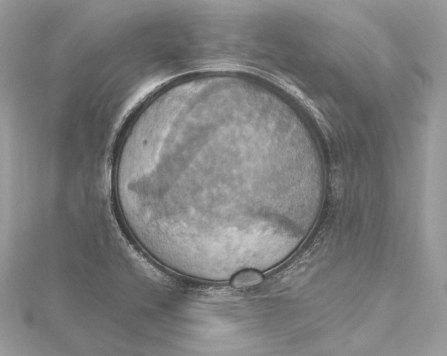 X0000115561416200912041043