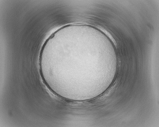 X0000115561485200912041042