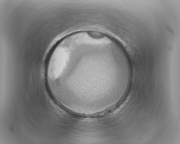 X0000115561506200912041042