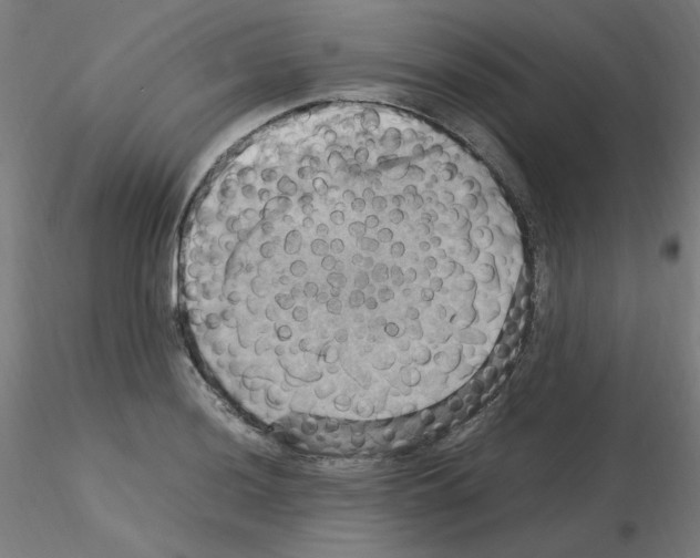 X0000115561036200912181612