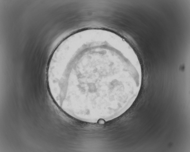 X0000115561183200912181610