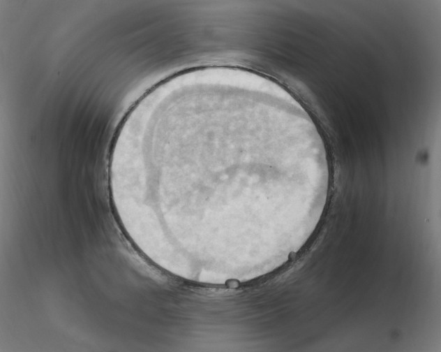 X0000115561184200912181610