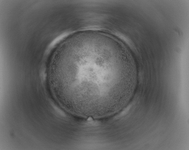 X0000115581406200911101138