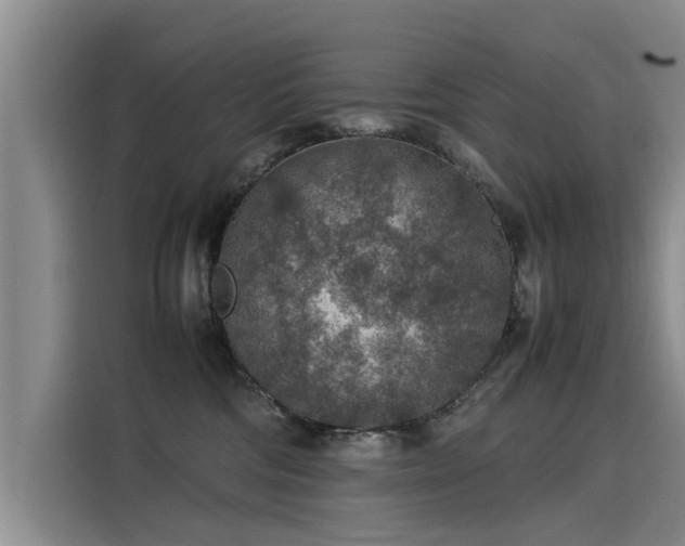 X0000115580330200911171015