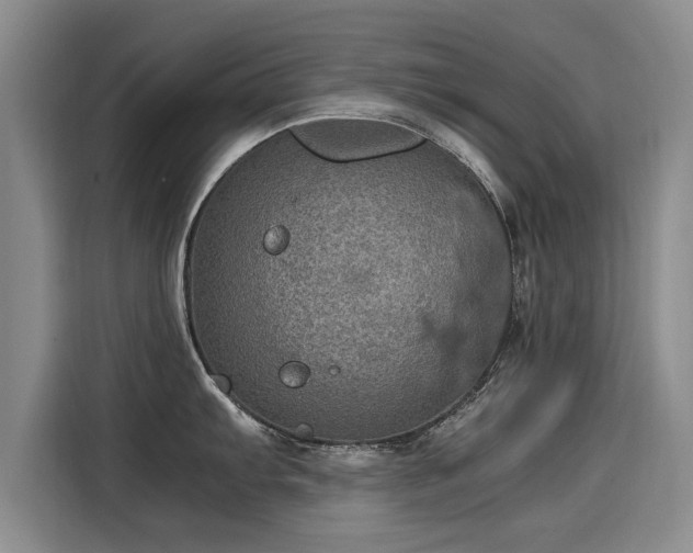 X0000115581103200911171004