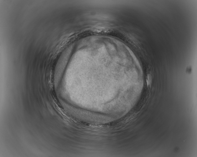 X0000115581396200912081015