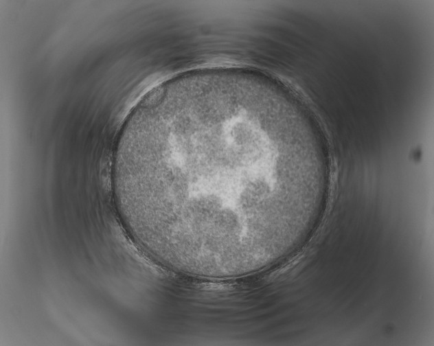 X0000115581409200912081015