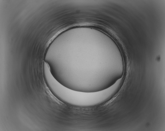 X0000115581417200912081015