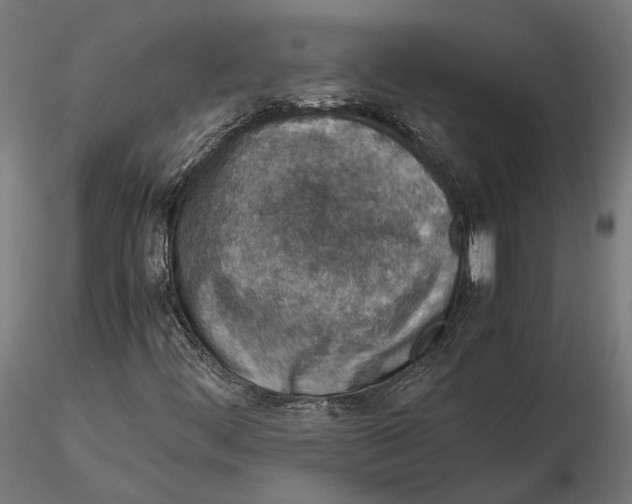 X0000115581444200912081015