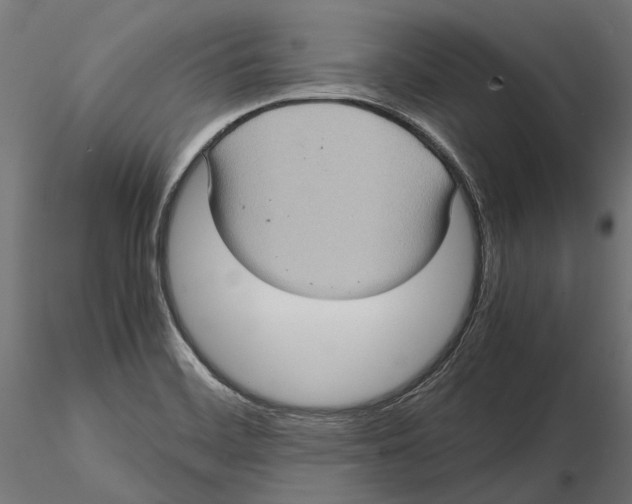 X0000115581468200912081014