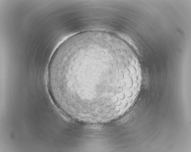 X0000115581040200912221045