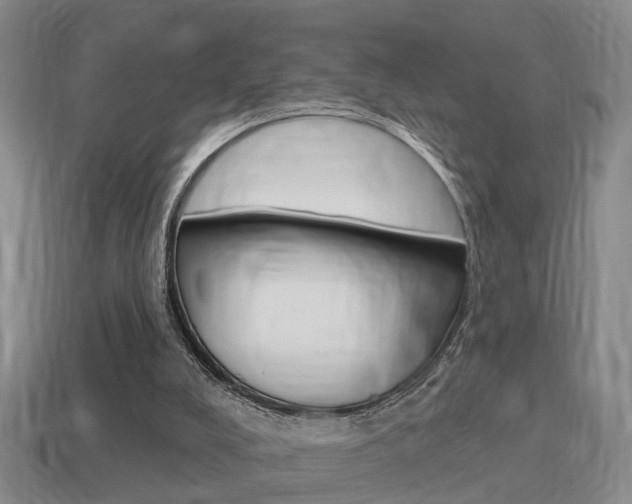 X0000115590008200911100941