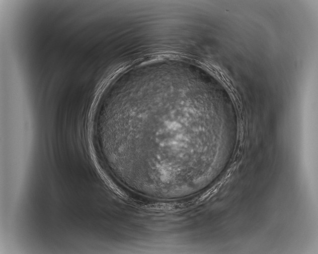 X0000115590049200911171038