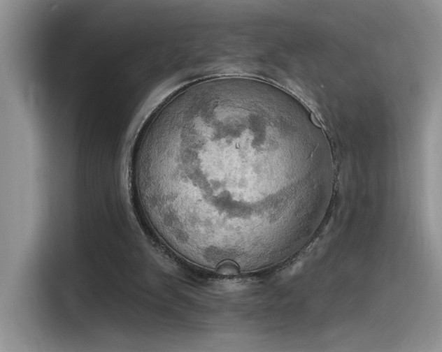 X0000115590103200911171038