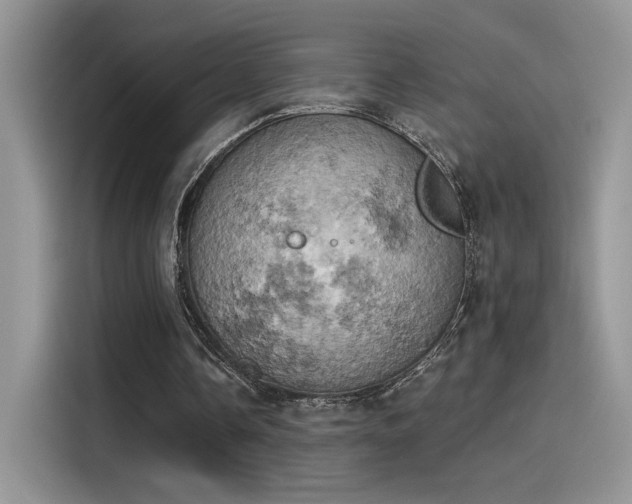 X0000115590338200911171034