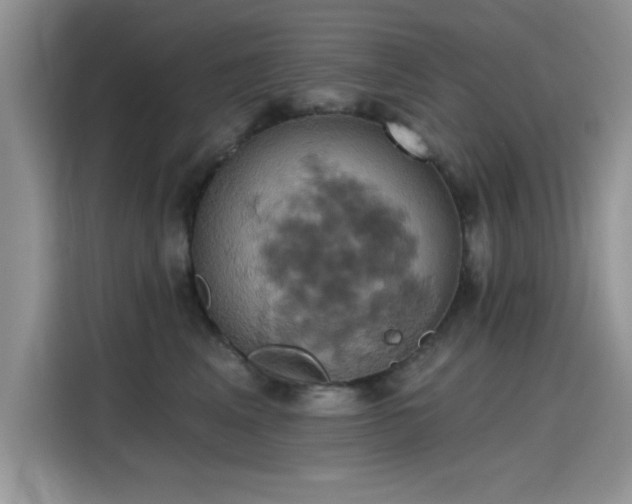 X0000115590617200911171031