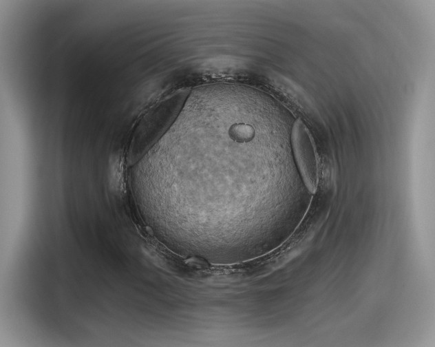 X0000115591060200911171025