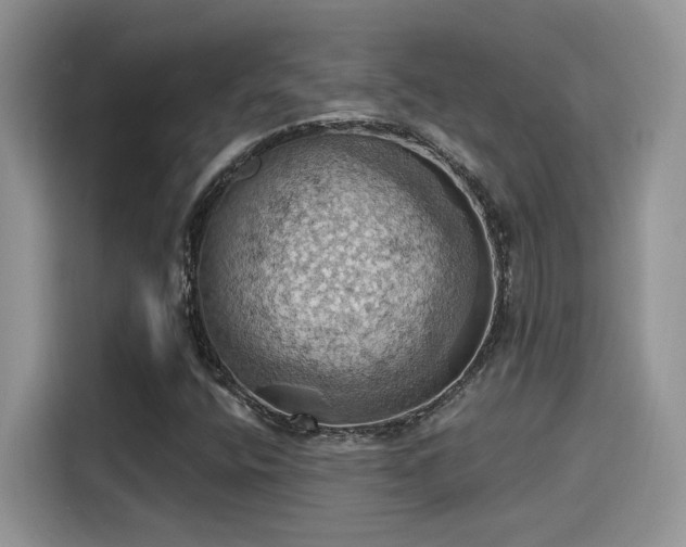 X0000115591400200911171020