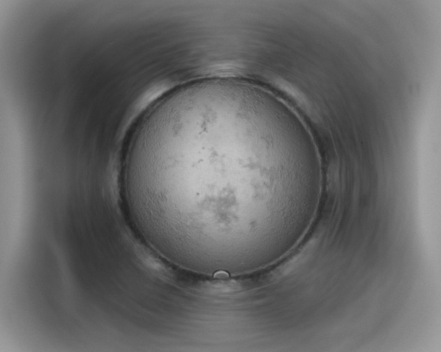X0000115591410200911171020