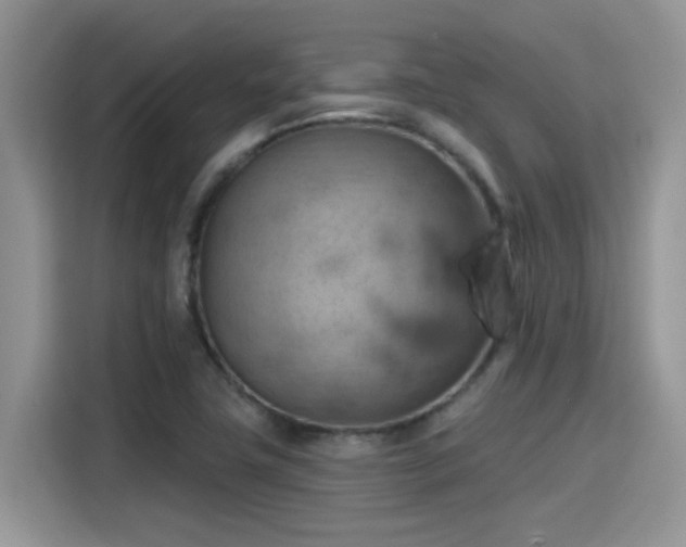 X0000115591411200911171020