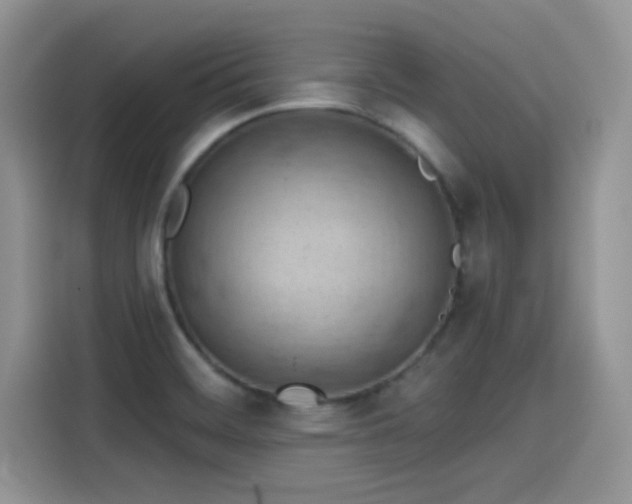 X0000115591468200911171020