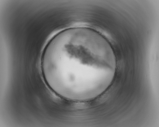 X0000115591470200911171020