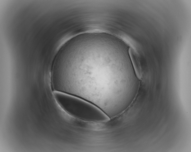 X0000115591476200911171020