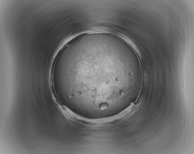 X0000115591485200911171020