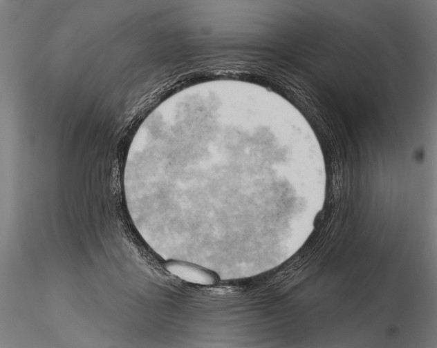 X0000115590411200912081054