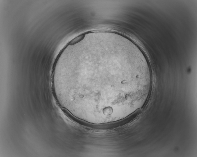 X0000115591485200912081037