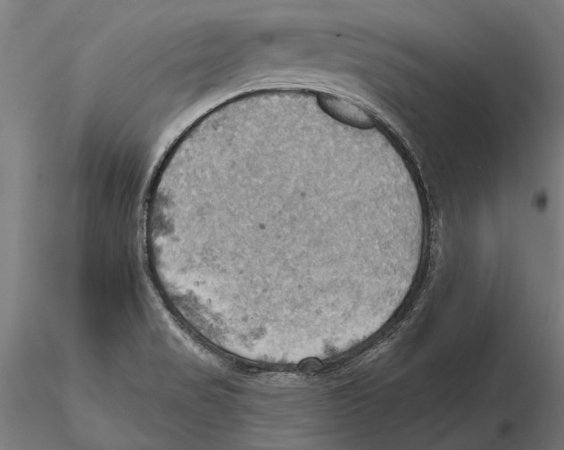 X0000115591517200912081037