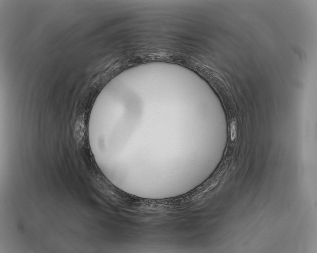 X0000115601011200911100947