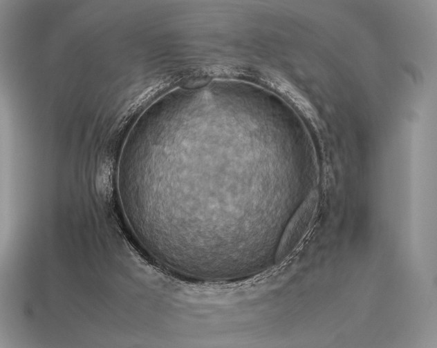 X0000115600009200911101416