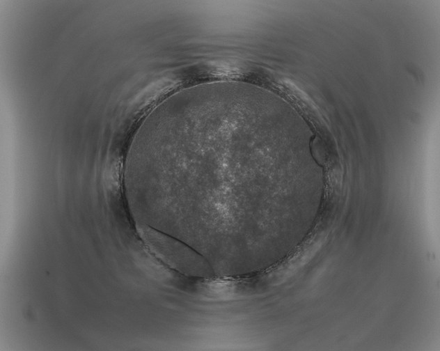 X0000115600325200911101411