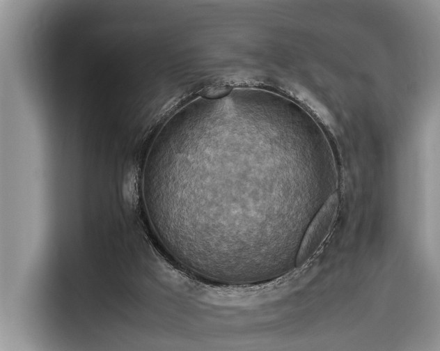 X0000115600009200911171137