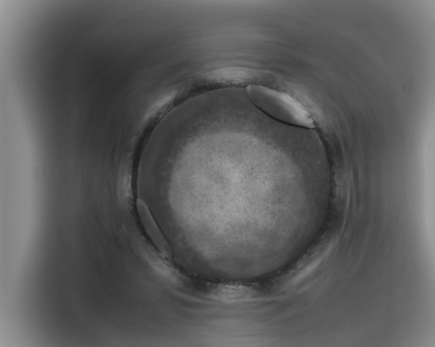 X0000115600399200911171132