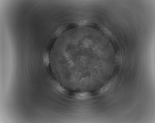 X0000115600479200911171132