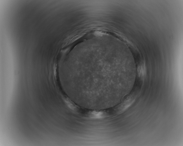 X0000115600570200911171130