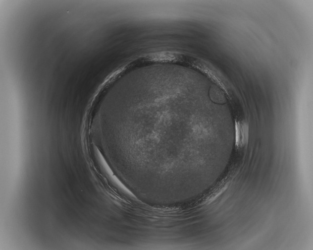 X0000115600723200911171127