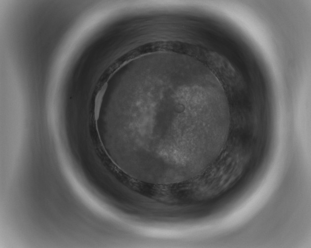 X0000115600766200911171128